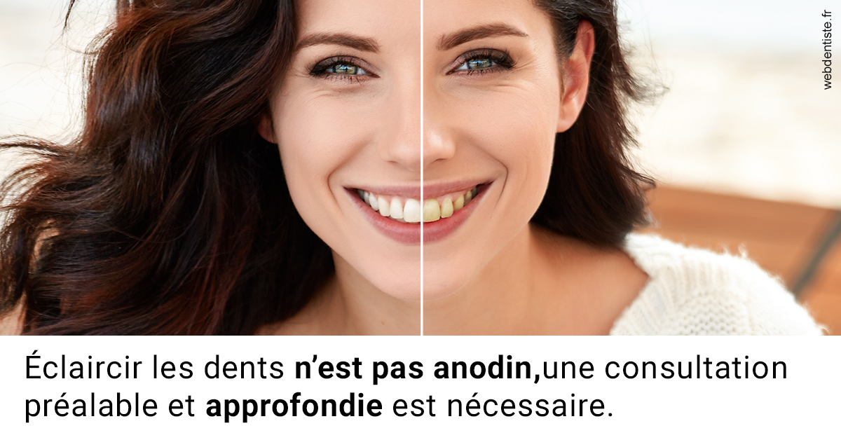 https://selarl-cabinet-onciu-et-associes.chirurgiens-dentistes.fr/Le blanchiment 2
