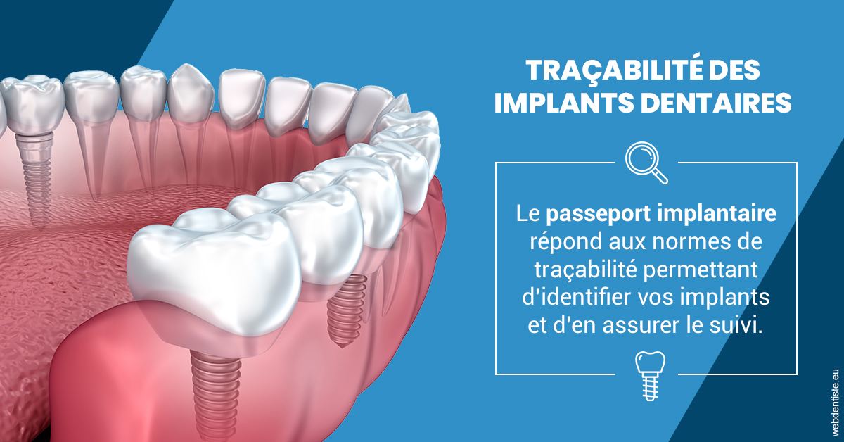 https://selarl-cabinet-onciu-et-associes.chirurgiens-dentistes.fr/T2 2023 - Traçabilité des implants 1