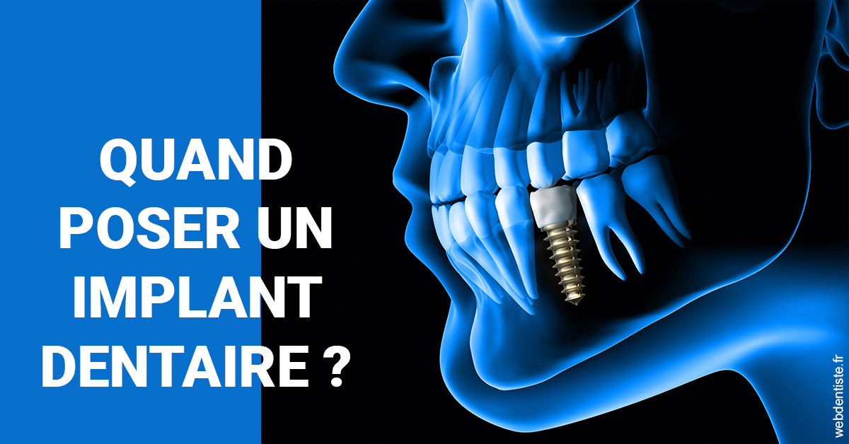 https://selarl-cabinet-onciu-et-associes.chirurgiens-dentistes.fr/Les implants 1