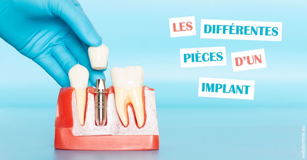 https://selarl-cabinet-onciu-et-associes.chirurgiens-dentistes.fr/Les différentes pièces d’un implant 2
