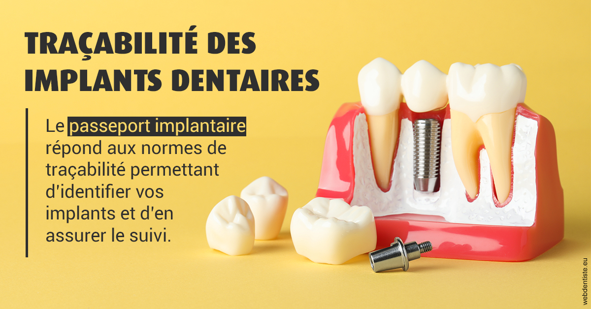 https://selarl-cabinet-onciu-et-associes.chirurgiens-dentistes.fr/T2 2023 - Traçabilité des implants 2