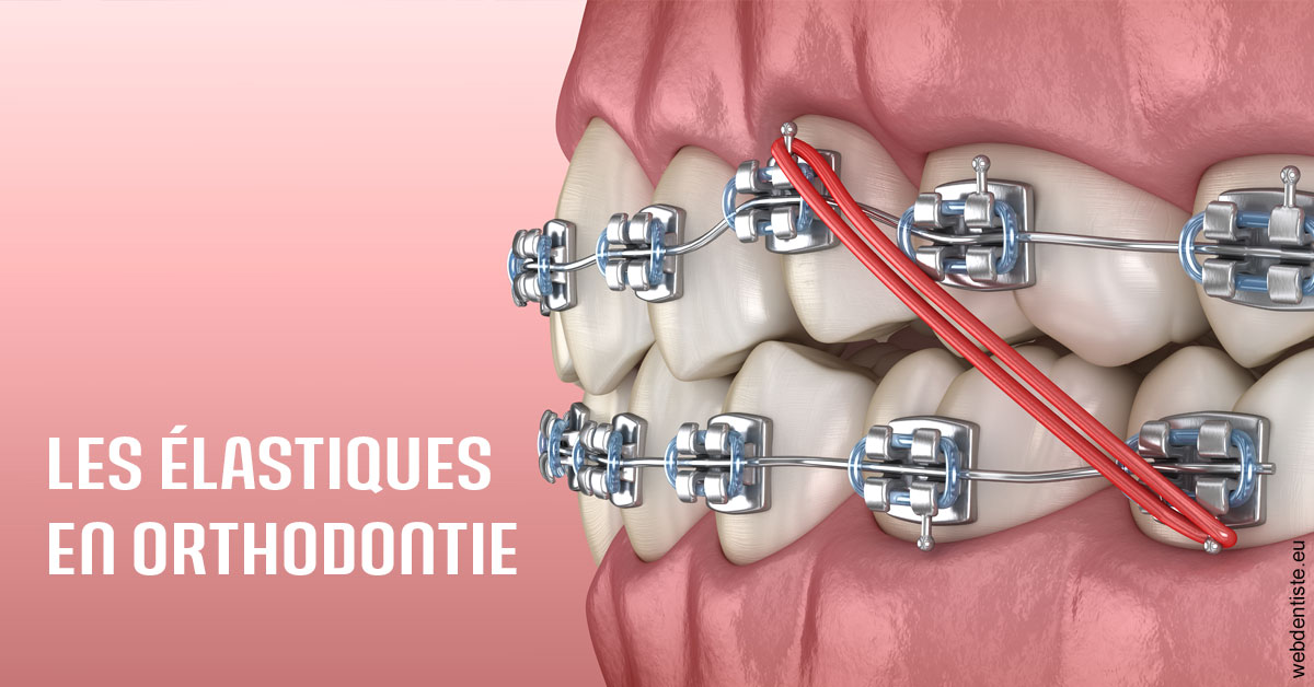 https://selarl-cabinet-onciu-et-associes.chirurgiens-dentistes.fr/Elastiques orthodontie 2