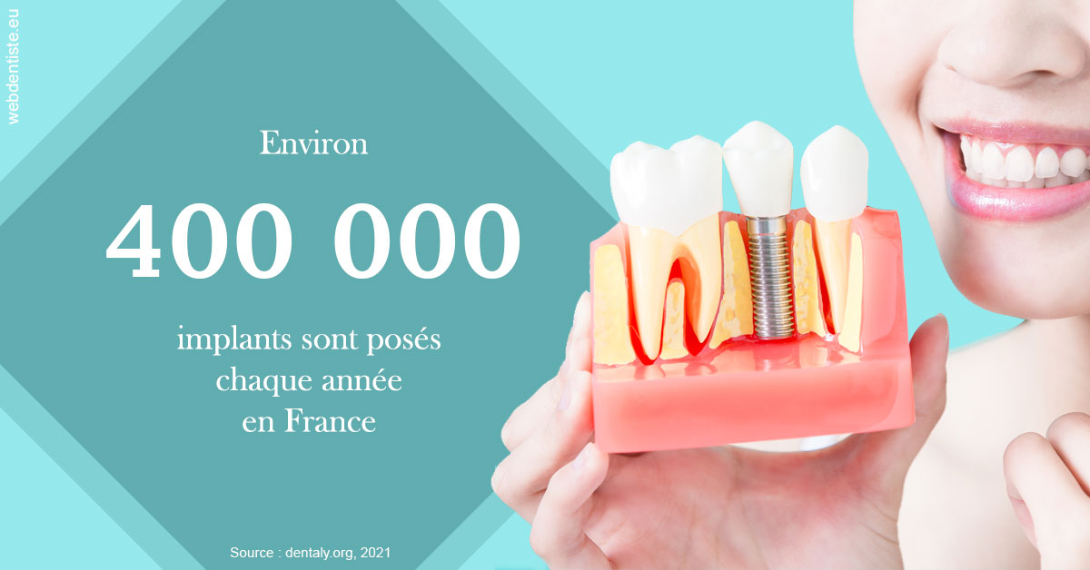 https://selarl-cabinet-onciu-et-associes.chirurgiens-dentistes.fr/Pose d'implants en France 2